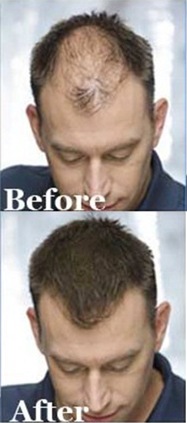 Alt Image